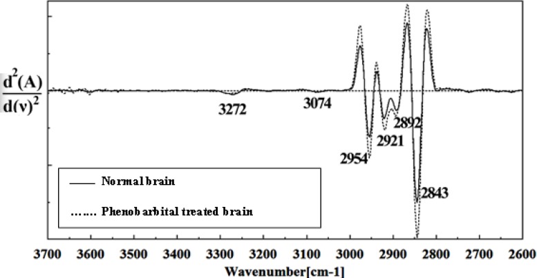 Second derivative of mean FTIR spectra of normal (solid line) and Phenobarbital- treated (dot line) brain sections in the 3700–2600 cm-1 wave number region.