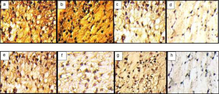 Immunohistochemical sections of neo-cartilage formed by TGF-β3, KGN and ASU in fibrin scaffold. Immunostained with anti-type II collagen antibodies (a: TGF-β3, b: KGN c: ASU and d: Control) and anti-type X collagen antibodies (e: TGF-β3, f: KGN g: ASU and h: Control) in vitro culture, magnification ×40