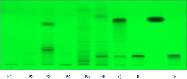 Chromatograms obtained from separation of plant extracts of P1, P2, P3, P4, P5, P6 and standards Q: quercetin, R: rutin, C: Luteolin and V: vitexin (sample codes are explained in Table 1) Visualization was under UV light of wavelength 254 nm