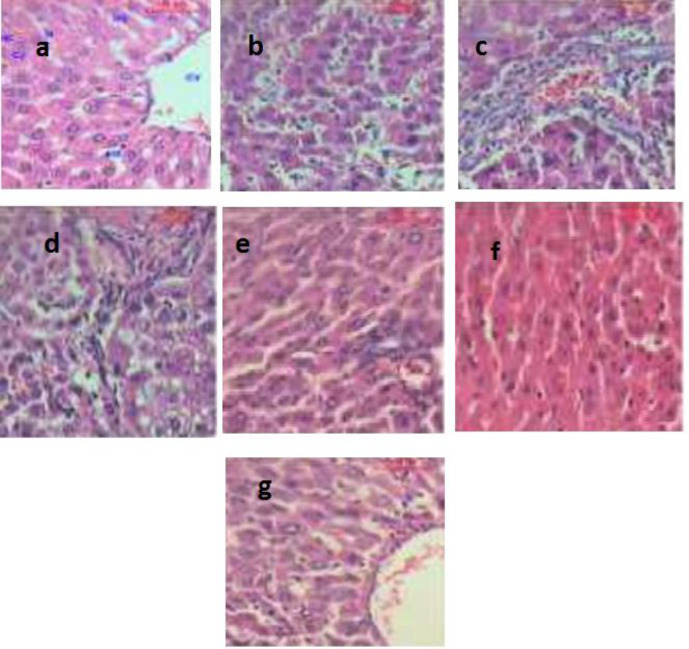 It shows photomicrographs (H&E X400) of various liver tissues from control and experimental animals. (a) shows the architecture of a hepatic lobule of control rats. The central vein (CV) lies at the center of the lobule surrounded by the hepatocytes (HC) with strongly eosinophilic granulated cytoplasm (CY) and distinct nuclei (N). Between the strands of hepatocytes, the hepatic sinusoids are shown (HS), (b) shows the area of the aberrant hepatocellular phenotype of DEN group with variation in nuclear size, hyperchromatism, and irregular sinusoids, (c) shows abnormal hepatocellular histology of DEN group with prominent hyperbasophilic preneoplastic focal lesions and eosinophilic clear cell foci, (d) shows trabeculae of hepatocellular carcinoma in DEN group consists of highly pleomorphic tumor cells and degenerated tumor cells, (e) shows the portal lobules of DEN + LCB group that appear more or less like the control one. Notice the activated Kuppfer'cells, (f) shows hepatic lobule of DEN + FnC60 group resembling control one, (g) shows many of the hepatocytes in DEN + LCB + FnC60 group appear more or less like normal
