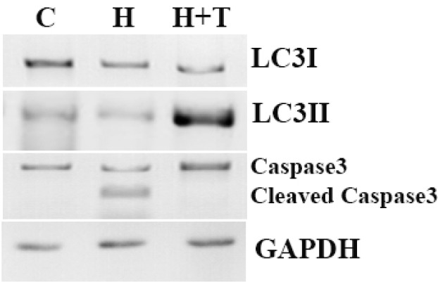 Western blot analyses of LC3, p62 and caspase-3 protein expression in control (lane1), H2O2 (lane2) and H2O2+trehalose (lane3) groups. Autophagic flux was examined by means of LC3 I/II conversion with the use of Western blot with LC3 antibody. LC3I, LC3II, p62 and Cleaved caspase 3 were detected using specific antibodies. GAPDH was used as an internal control. Caspase-3 was formed from a 32 kDa zymogen (inactive) that was cleaved into 17 kDa and 12 kDa subunits (active).