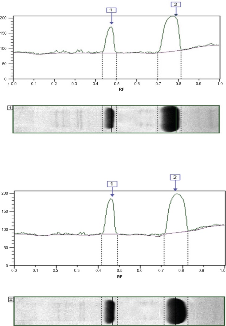 Densitometric comparison of two preparations on native gel stained with coomassie blue. (A) Heberkinasa®, (B) Streptase® Analysis of biological activity of native and recombinant streptokinase using Clot lysis and Chromogenic substrate assay