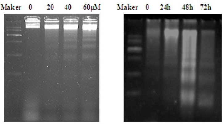 DNA fragmentation induced by EN in MCF-7 cells. The cells were treated with varied concentrations of EN (0, 20, 40 and 60 μM) for 48 h (A)or treated with 40 μM for 24 h, 48 h and 72 h (B). DNA was isolated by agarose gel electrophoresis and analyzed by ethidium bromide staining.