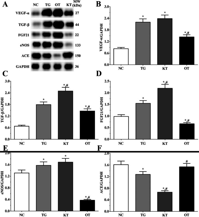 Effect of taxifolin on expression of angiogenesis related proteins of cardiomyocytes. (A) Western blotting analysis of angiogenesis related proteins. (B, C, D, E and F) Quantitative analysis of angiogenesis related proteins. *P < 0.05 vs. NC group, #P < 0.05 vs. TG group. Data was presented as a mean ± SD. Each experiment was repeated for three times independently