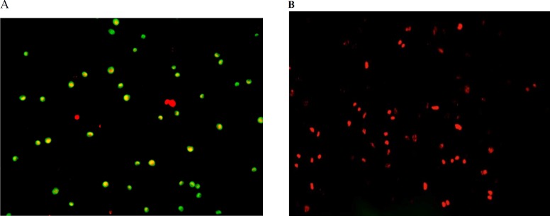 Fluorescence spectroscopy examination onhuman hepatocellular carcinoma (A) andhuman umbilical vein endothelial (B) cells after 24 h exposure to 100 µg/mL of Silibinin. Cells express more of apoptotic cell death (A; green dotted cells) at the beginning followed by secondary necrosis (B; red dotted and homogeny cells) afterthe exposure to Silibinin