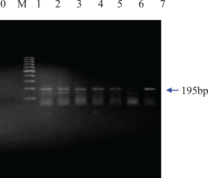 Agarose gel electrophoresis of PCR products from DNA of food samples containing CaMV35s.