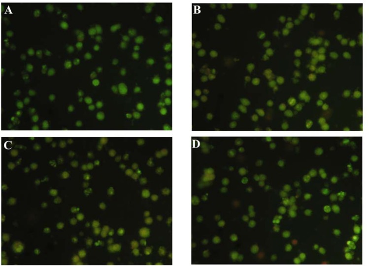 Apoptosis of HepG2 cells induced by compounds 2, 3 and 4 folowing 48 h treatment. After treatment with compounds 2, 3 and 4 and 48 h , the cells were stained with AO/EB at room temperature . The samples were observed under a fluorescence microscope immediately(×100) . (A) Control ; (B) 20 µM Compound 2 ; (C) 20 µM Compound 3;and (D) 20 µM Compound 4