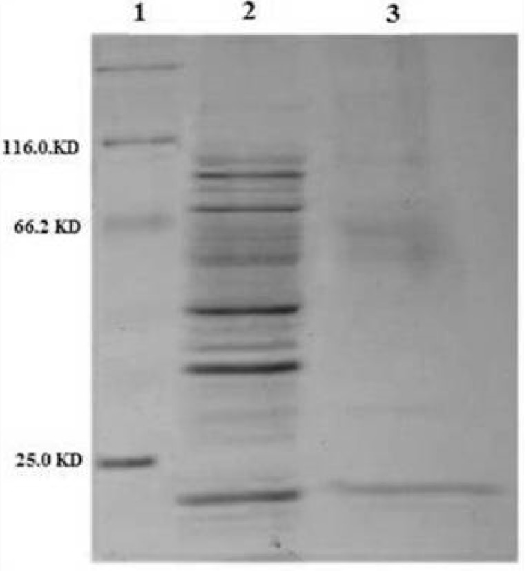 SDS-PAGE analysis of purified periplasmic TRAIL by Ni-NTA affinity chromatography. Lane 1: protein marker. Lane 2: 10 µg of periplasmic fraction of E.coli BL21 (DE3) after induction. Lane 3: 1 µg of purified TRAIL after elution by imidazole