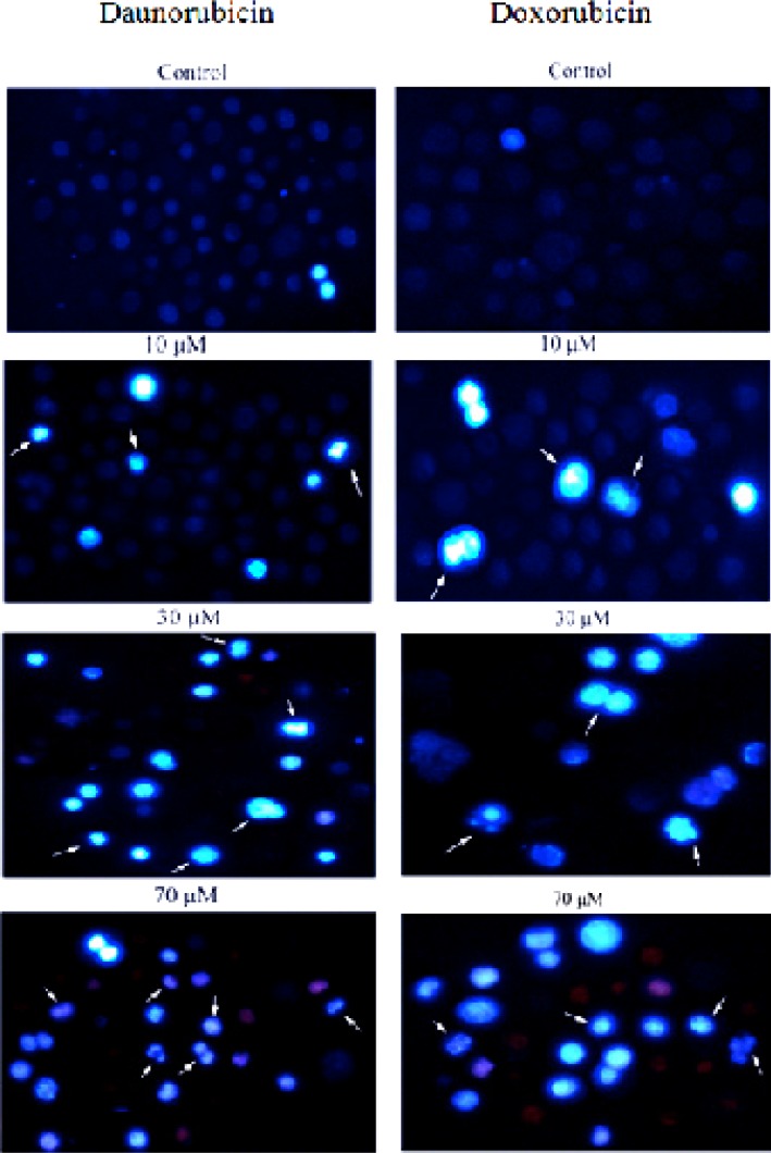 Morphological changes in the non-adherent multipotent hematopoietic cells of mouse bone marrow cells induced in the presence of various concentrations of daunorubicin and Doxorubicin for 4 h and staining with Hoechst 33258. Arrows indicate the cells with condensed chromatin and/or fragmented nuclei. For clarity, only some examples are labeled. (Magnification 200X