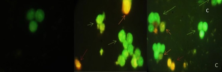 Acridine orange/ethidium bromide staining of HT-29 cells to detect apoptosis induced by different extract of 40 µg/mL of (A) negative control (B) CM(C) CF. Live cells are uniformly green, whereas apoptotic cells (green arrows for early apoptosis (EA), orange arrow for late apoptosis (LA) and apoptotic bodies) characterized by shiny green (EA) and yellow-orange staining (LA) due to chromatin condensation and loss of membrane integrity. Red arrow for necrosis. Magnification400