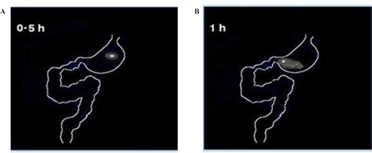 Gamma scintigraphy study of starch matrix tablets (F1) on rabbits at time point (A) 0.5 h and (B) 1 h.