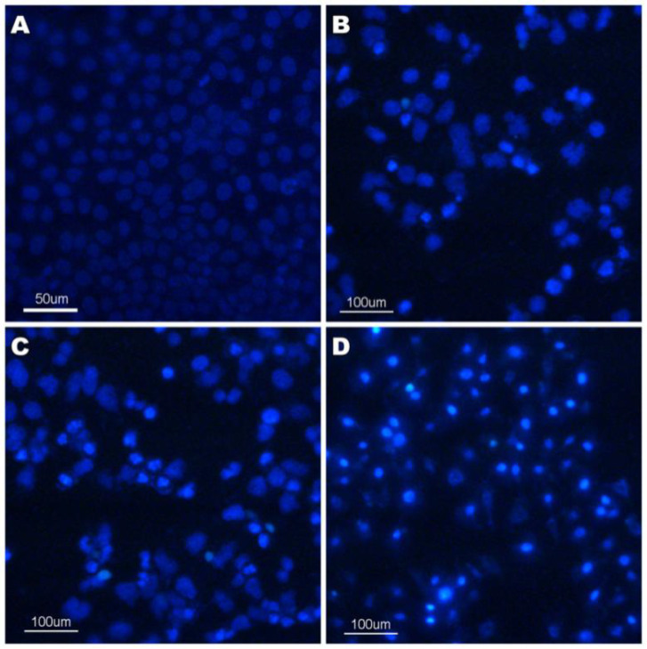 Hoechest 33258 staining of compound 4a in HeLa cell line. (A)Control; (B) 12.5 μmol/L 4a for 24 h; (C) 25 μmol/L 4a for 24 h; (D) 50 μmol/L 4a for 24 h