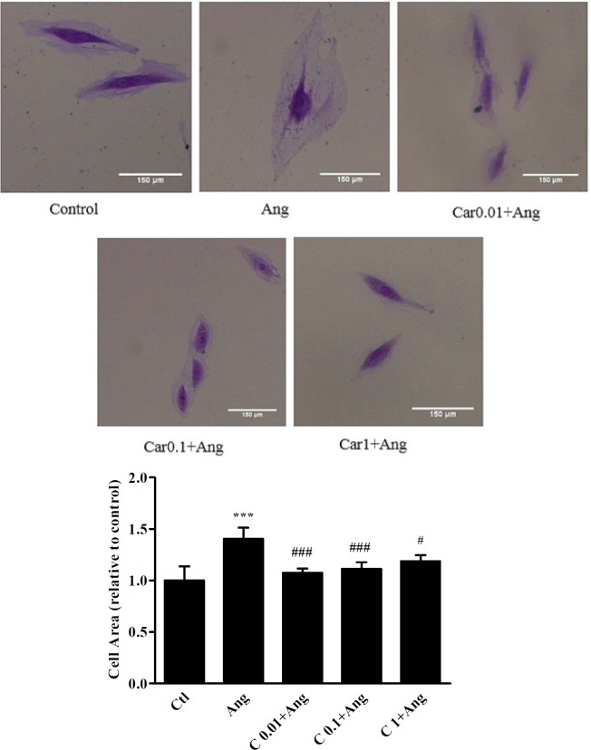 H9c2 cells size after treatment with different concentrations of carvacrol. The images show the cell size in un-treated (Ctl) and angiotensin II treated H9c2 cells (Ang, 1 μM) in the presence or absence of carvacrol. A significant decrease in cell size was observed when hypertrophied cells were pretreated with 0.01, 0.1 and 1 μM of carvacrol. Data are expressed as mean ± SEM. ***P < 0.001 vs. Ctl, #P < 0.05 and ###P < 0.001 vs. Ang