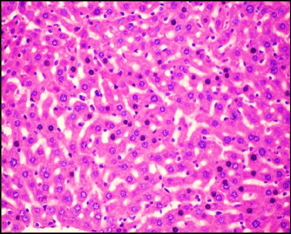 Photomicrograph of liver of mice (H&E, 400×) from S.thermophilus + Cd prevention group showing No necrosis and reduction of cytoplasmic vacuolization.