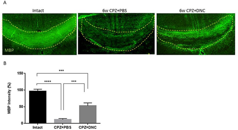 DNC treatment showed protective effect on MBP content of CC after CPZ intake. A) Representative images from brain sections IHF for MBP, marker of main components of myelin sheath. B) Analysing the intensity of MBP in CC of mice from intact and CPZ+PBS group showed that 6 weeks CPZ intake lead to significant depletion in myelin content of CC; however, the degree of myelination was significantly higher in DNC treated group compared to PBS treated one. n = 27 brain sections from 3 mice, per experiment group. Values are given as mean ± SEM as the results of ordinary one-way ANOVA followed by Tukey’s multiple comparison test