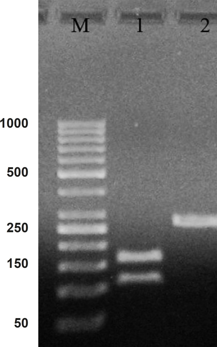 PCR product of hepcidin cDNA in 1% agarose gel electrophoresis. Lane M is the molecular marker (GeneRuler™ 50 bp DNA Ladder). Lane 1 is the effect of ALU-1 restriction enzyme on PCR product confirming it as a hepcidin cDNA. Lane 2 is PCR product with 260 bp weight expected for hepcidin cDNA
