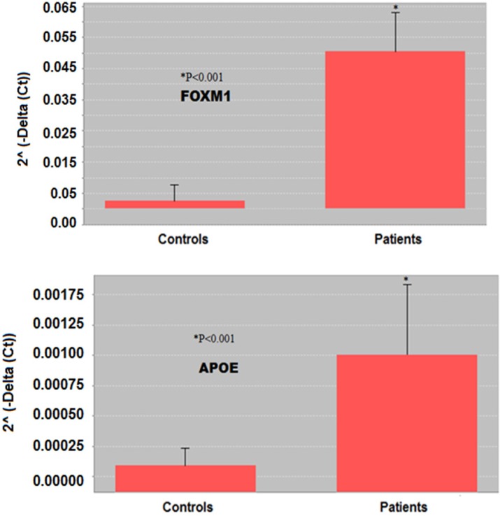Comparison of FOXM1 and APOE expression between controls and SM-exposed patients by 2˄ (-Delta (Ct)). All RT-PCR experiments were performed in three independent experiments conducted in triplicate. Based on gene 2˄ (-Delta (Ct)), the expression of FOXM1 and APOE genes in lung tissue of the patients was significantly (p < 0.001) higher than in controls. *p <0.05 is considered as significant difference