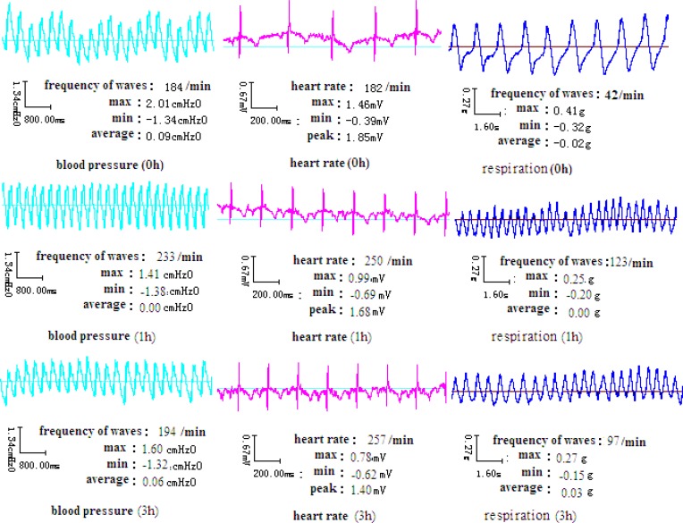 Mean concentration-time curve of plasma MA after administration of MA alone or co-administration of MA and EtOH (n=8).