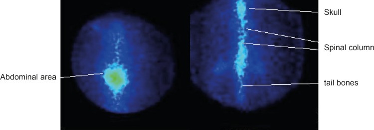 SPECT images of 177Lu-EDTMP (right) and 177LuCl3 (left) 24 h post injection in wild-type rats