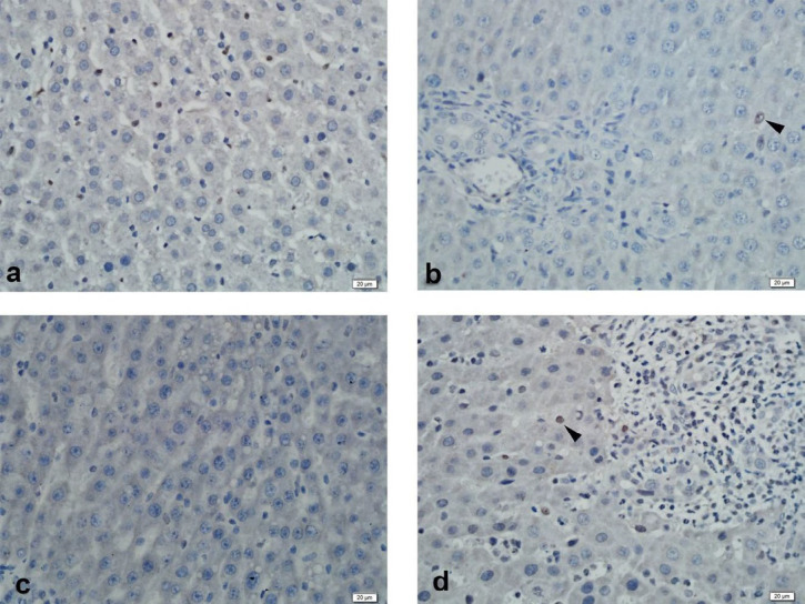 Immunohistochemistry of liver PXR. (a) Control Group: Mild staining; (b) BDL Group: Mild staining; (c) SPL1 Group: No staining; (d) SPL2 Group: Mild staining