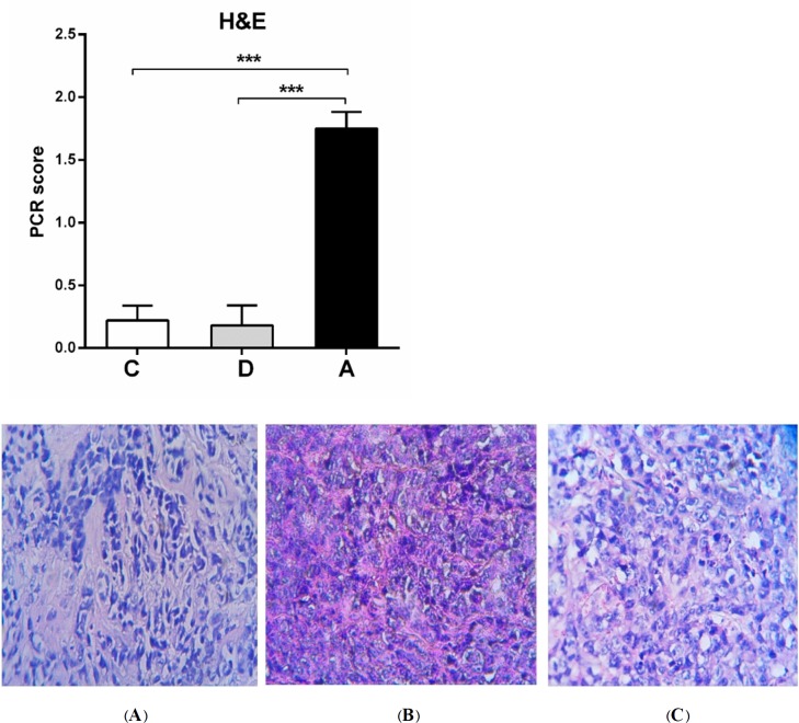 H&E staining of tumor groups. pCR scanning based on H&E stained samples of tumor-bearing mice showed significant tumor destruction by umbelliprenin (A) compared to liquid paraffin (B) and normal saline (C) groups.