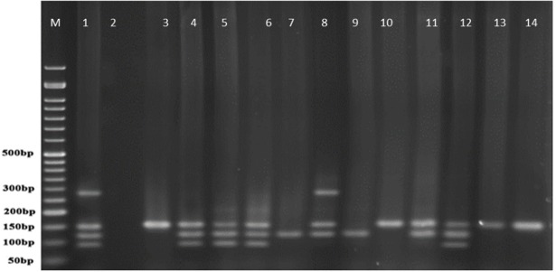 PCR products of well 1 represent positive control. The second well represents the PCR product of distilled water as template in PCR reaction as negative control. Wells from number 3 to 14 contain PCR products of human samples amplified with four specific primer pairs of exoenzymes under study