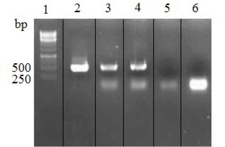 RT-PCR analysis of total RNA isolated from untransfected and rSp2.0. PCR products were electrophoresed on a 1% agarose gel. Lane 1, 1kb DNA markers; lane 2, amplification of variable region of heavy chain from recombinant vector pFUSE-CHIg-hG4-VH; lane 3, amplification of variable region of heavy chain gene from RNA of rSp2.0; lane 4, amplification of variable region of light chain gene from RNA of rSp2.0; lane 5, amplification of variable region of heavy chain gene from RNA of untransfected Sp2.0; lane 6, amplification of variable region of light chain gene from RNA of untransfected Sp2.0.