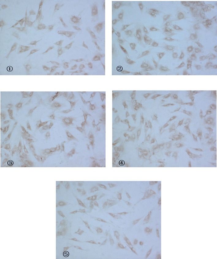 Expression of CaN protein in cardiac myocytes with CnA anti-body as a marker (IC, × 200) (① control ②model ③Rutin I 0.8 mg/L ④Rutin II 4.0 mg/L ⑤Rutin III 8.0 mg/L).