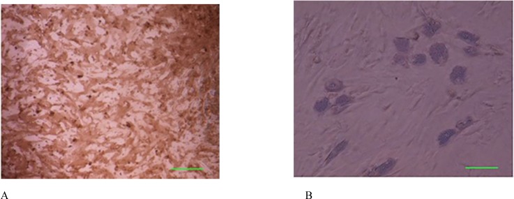 Osteogenic and adipogenic differentiation of bone marrow mesenchymal stem cells in the third passage. (A): Osteogenic differentiation was positive for alizarin red staining. (B): The adipose droplet in differentiated cells after incubating with adipogenic media. Scale bar for Figures A-B: 50 µm