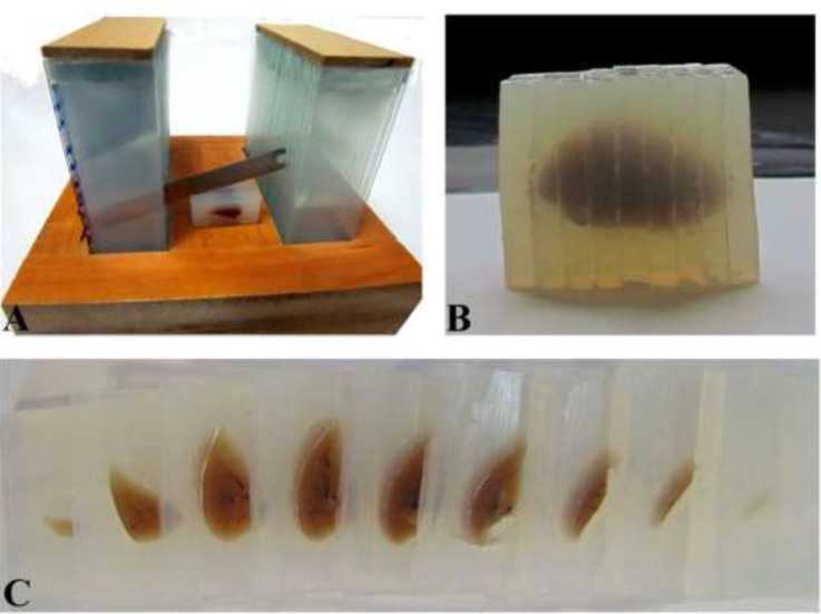 The lung sectioning. A. The lung was embedded in an agar block and cut using a tissue slicer. B and C. The sectioned block and slabs of the lung