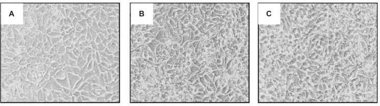 Morphological alterations of HeLa cells exposed to ICD-85 and ICD-85 NPs in cell culture medium for 24 h. (A) Micrograph of control cells (B) HeLa cells treated with 28 μg/mL of ICD-85 (C) HeLa cells treated with 28 μg/mL of ICD-85 NPs