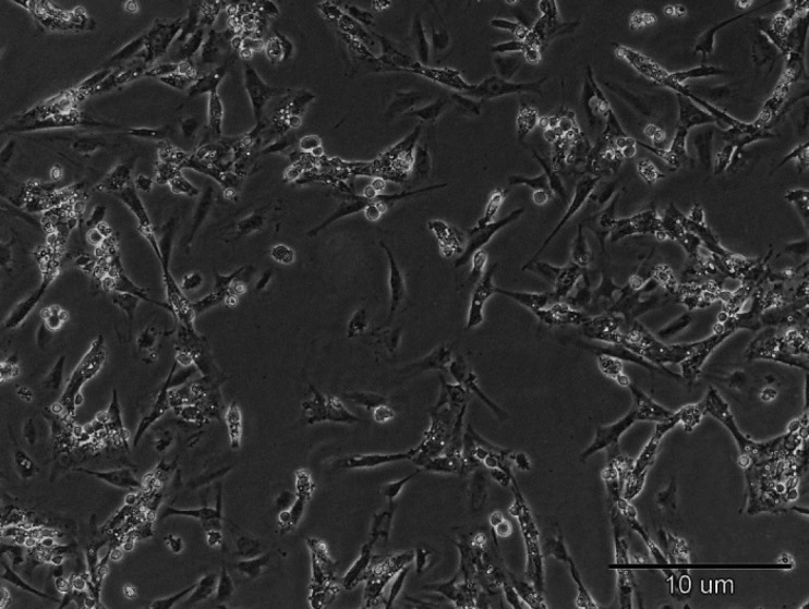 Phase contrast microscopy analysis after 14 days of culture of Sertoli cells shows Sertoli cells appeared fibroblast-like cells