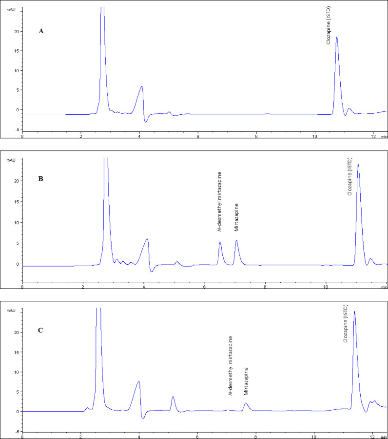 The chromatogram of blank plasma used in validation tests. Figure 2 b. The chromatogram of plasma example that contained NDM and MRP as 250 ng/mL concentration which is prepared by standard addition method used as quality control sample. Figure 2.c. The chromatogram of real plasma sample belongs to patient who was using 15 mg/day MRP