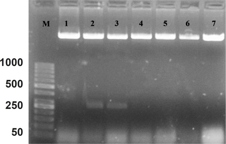 Patterns of “PFastBac HTB” digestion with NcoI enzyme on the obtained recombinant plasmids