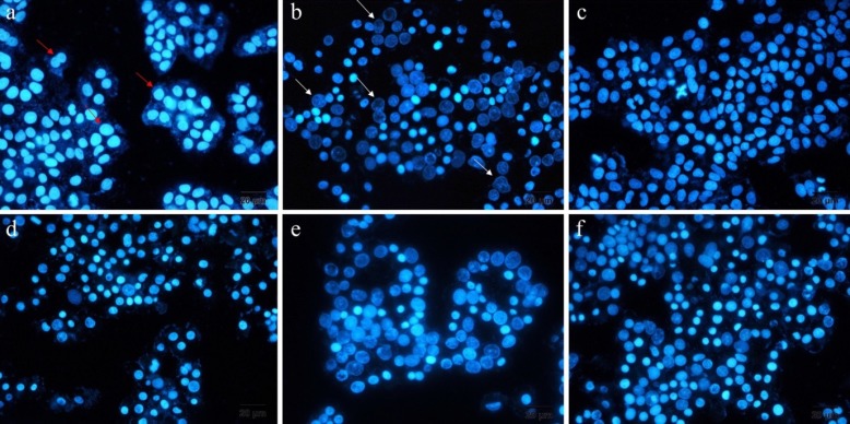 Displays fluorescent images of treated and untreated DAPI stained A549 cells, a) untreated, b) treated with docetaxel, c) blank, d) free drug, e) ELT loaded liposomes and f) ELT loaded NLCs (Red arrows shown healthy cell nuclei and white arrows shown fragmented cell nuclei samples