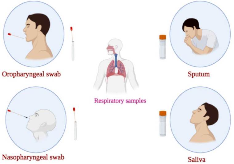 Different respiratory samples for COVID-19 detection. The respiratory tract samples for COVID-19 detection are divided into the upper (nasopharyngeal swab (NPS)/oropharyngeal swab (OPS), NP wash or saliva) and the lower (sputum) parts