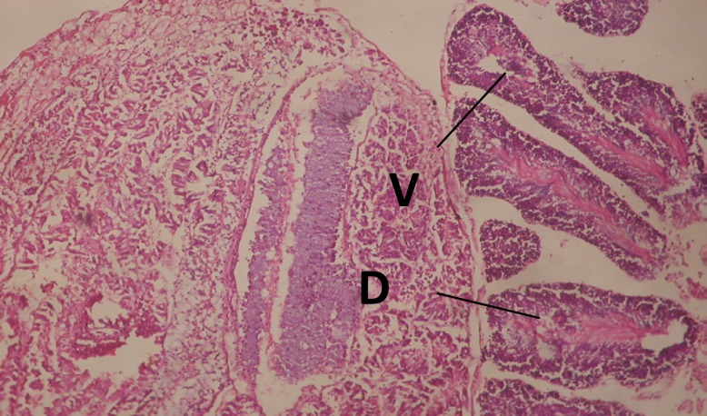 T.S. in treated B. alexandrina with 40 ppm leaves extract (Hermaphrodite region). D: degeneration V: vacuoles X= 200.