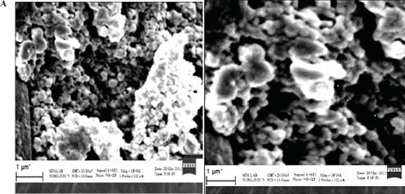 (A) Scanning electron microscopy (SEM) photomicrograph of Albumin-Nanoparticles; (B) SEM photomicrograph of Galactose coated Nanoparticles