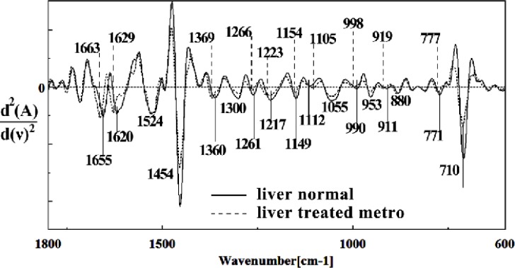 Second derivative of mean FTIR spectra of normal (solid line) and Metronidazole-treated (dot line) liver sections in the 600–1800 cm–1 wave number region