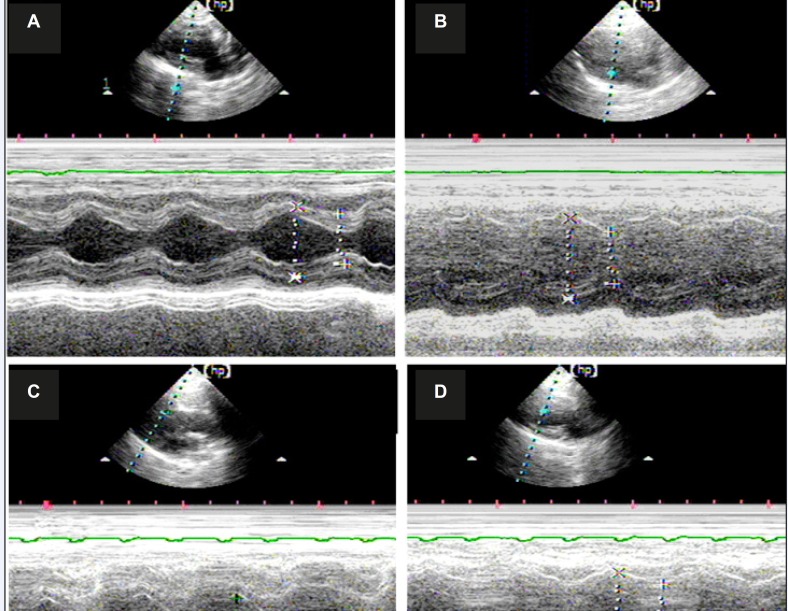 Typical M Echocardiography map of all groups shows that the heart is enlarged after myocardial infarction, whereas the ranges of relative motion of the ventricular septum and left ventricular wall were decreased. A) Echocardiogram of the rats in the sham operation group; B) echocardiogram of the rats in the vehicle-treated group; C) echocardiogram of rats in the MP group; and D) echocardiogram of the rats in the DOX group