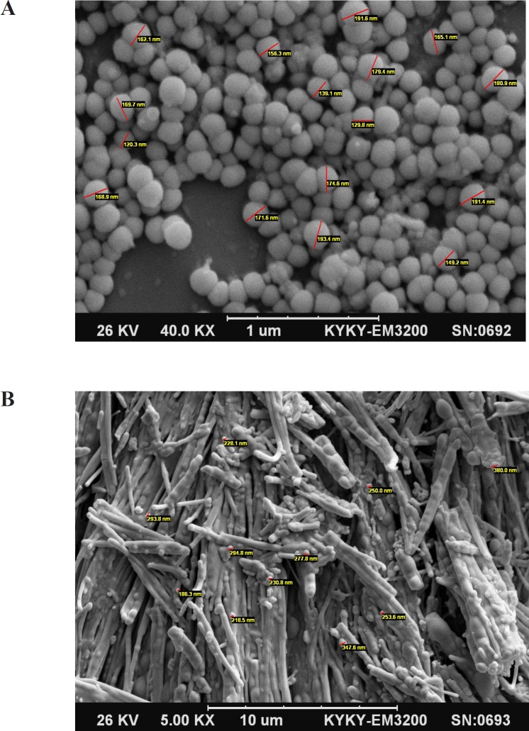 (A) Scanning electron microscopy picture of INH solid lipid nanoparticles before freeze drying. (B) Scanning electron microscopy picture of INH solid lipid nanoparticles after freeze drying