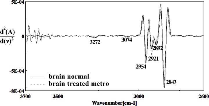 Second derivative of mean FTIR spectra of normal (solid line) and Metronidazole-treated (dot line) brain sections in the 2600–3700 cm–1 wave number region