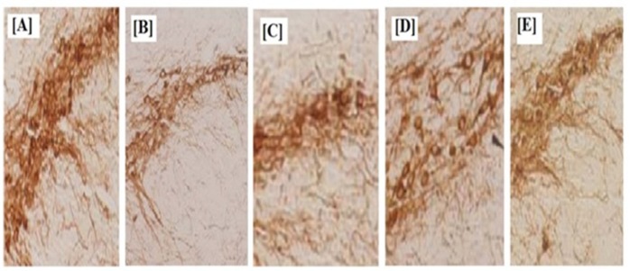 Effects of ibuprofen on MPTP-induced DA terminal loss in striatum and dopaminergic neuronal death in Substantia nigra, [A] Saline [B] MPTP treated Mice, [C] and [D] ibuprofen treatment after 15th day and 21st day, [E] Treated with IPG. Normal control vs MPTP (#p < 0.05) and MPTP vs treated group (*p < 0.05