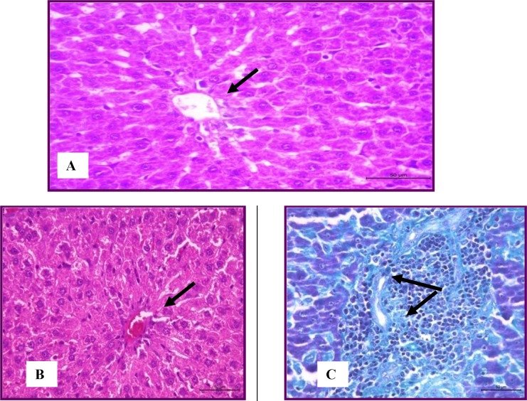 Stain (H&E) Liver of normal rats showing normal histological structure (A) and hyperlipidemic group showed mild degeneration of hepatocytes stained with (H&E) andmild leucocytic infiltration within theportal areas(Masson's trichrome) (B).