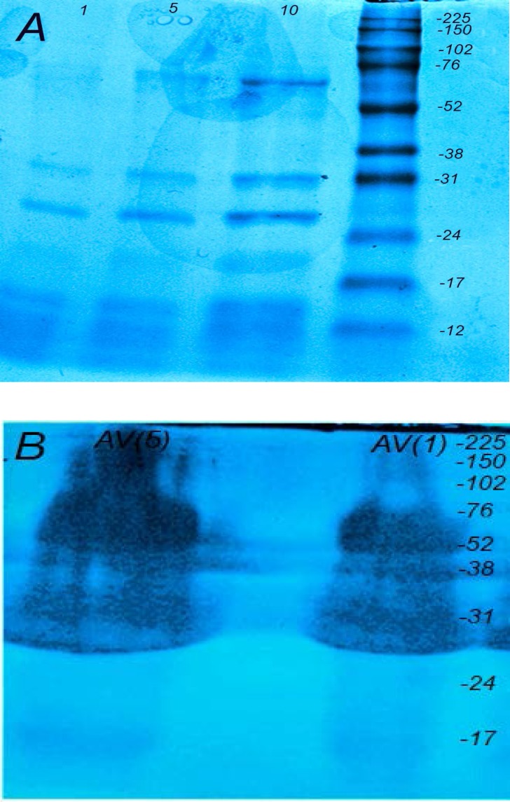 Protein components of Echis carinatus venom and Razi Institute antivenom. (A) The protein ingredients of Vipera.lebetina venom were separated with SDS-PAGE (12.5%) and stained with coomassie blue dye. (LANE 1:1, lane 2:5 and lane 3:10 μg). (B) Razi Institute antisnake antivenin was run on a 12.5% SDS-PAGE and stained with coomassie blue dye (lane 1:5 and lane 2:1 μg). Numbers on the right indicate the molecular weight of size markers