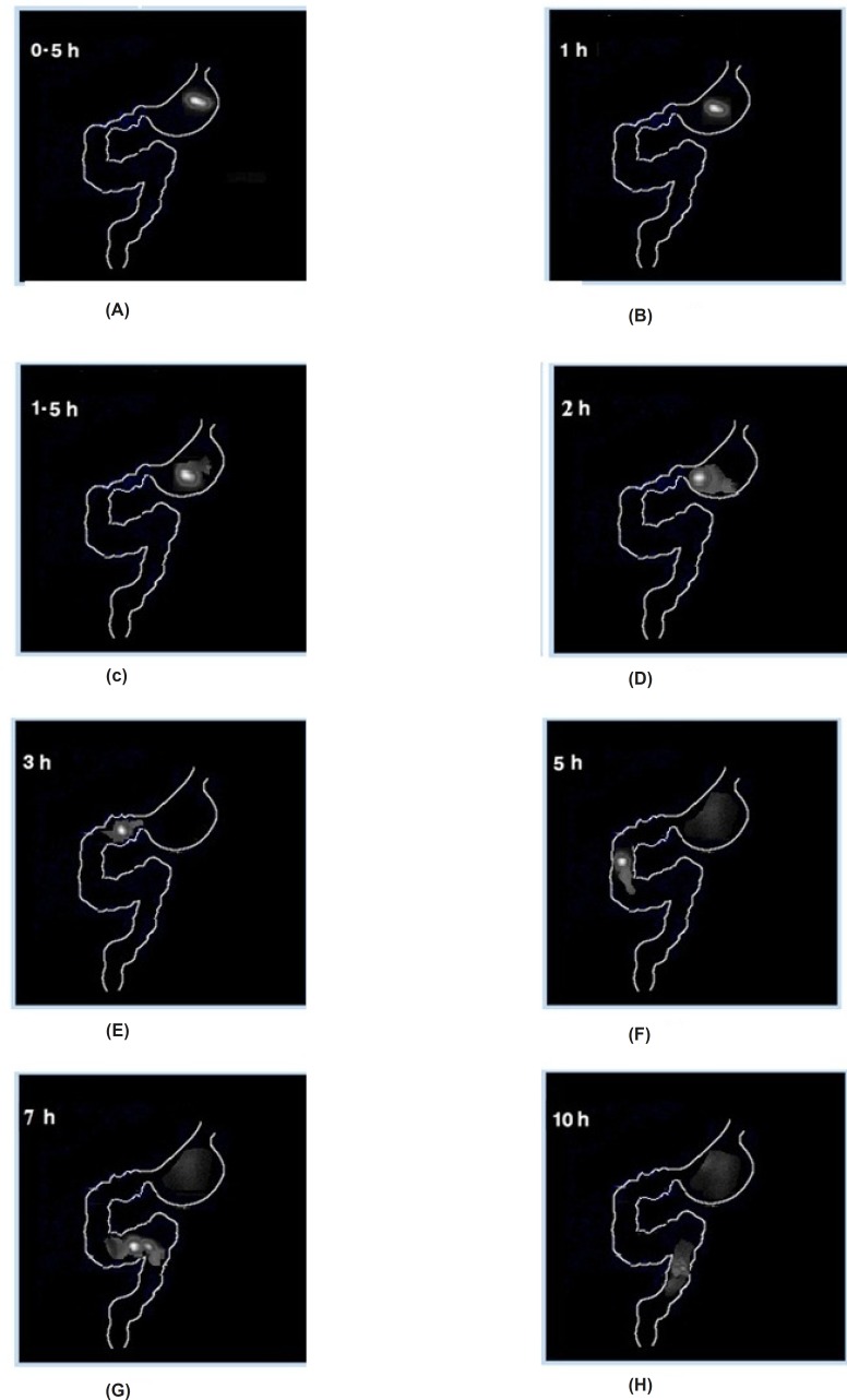 Gamma scintigraphic images of graft copolymer matrix tablets (St-g-PMMA, F3) on rabbits at time point (A) 0.5 h, (B) 1 h, (C) 1.5 h, (D) 2 h, (E) 3 h, (F) 5 h, (G) 7 h and (H) 10 h.