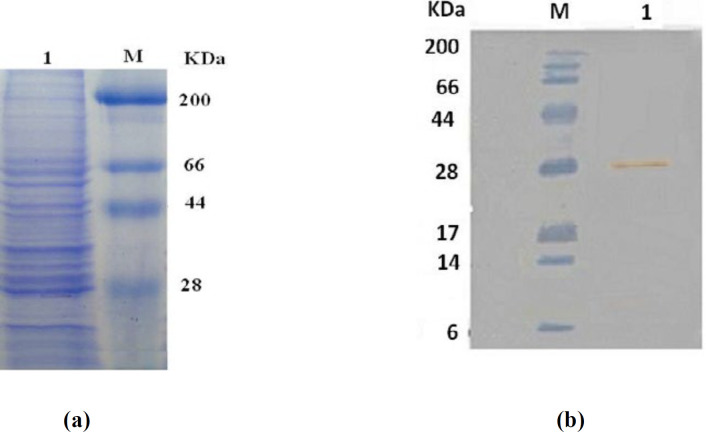 (a) rhGM-CSF protein expression analysis by SDS-PAGE Lane M, molecular weight marker (kDa) Lane 1, rhGM-CSF protein, (b) rhGM-CSF protein expression was confirmed by Western blot analysis Lane M, molecular weight marker (kDa) Lane 1, rhGM-CSF protein