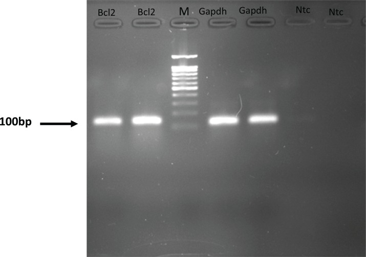 Gel electrophoresis analysis of the PCR products.NTC, non-template control. M, DNA Size marker