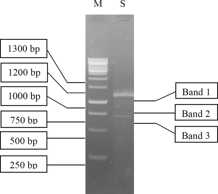 Visualization of cDNA synthesized using RT-PCR (S) on 1.1% agarose gel. M is a 1 kb DNA ladder marker
