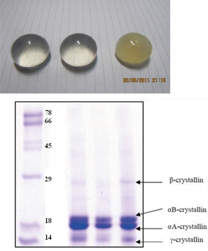 (Top) healthy and opaque bovine lens, collected in this study. (Bottom) SDS-PAGE pattern of purified α-crystallin (middle), crude extract (right) and molecular size markers (left). Further details are given in Experimental procedures